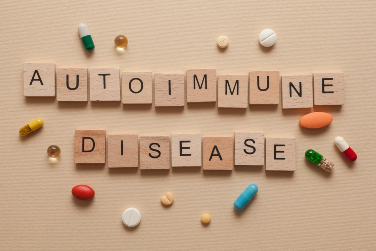 Boli Autoimune Asociate Cu Sindromul Sj gren Sjogren boli-autoimune-asociate-cu-sindromul-sj-gren-sjogren